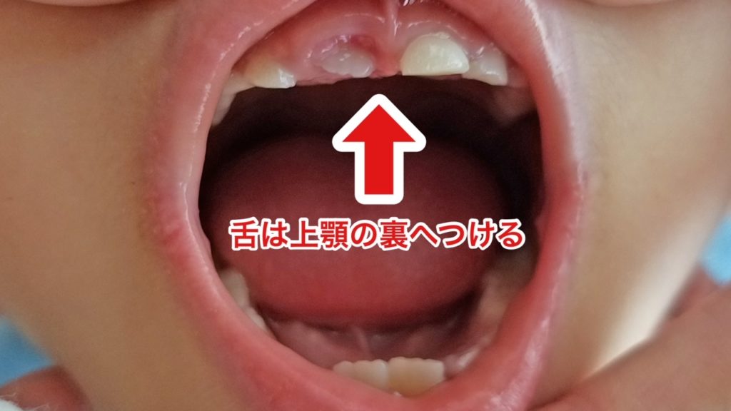 口を開けた子供の舌の位置を示す画像